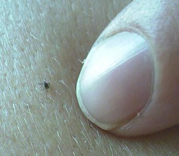 Lyme_Tick_1